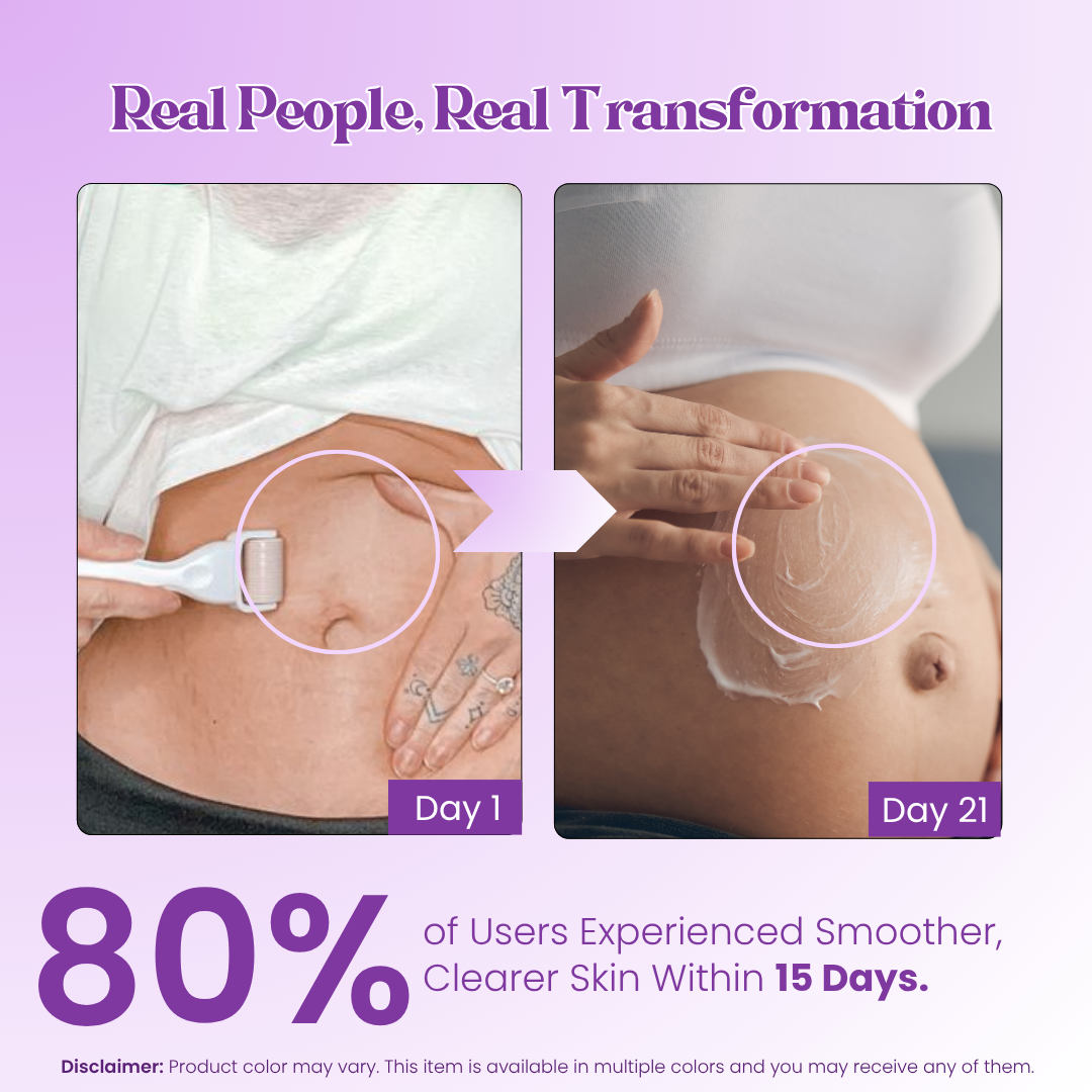 Derma Roller