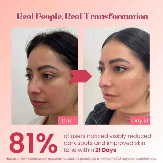 Dark Spot Removal Cream