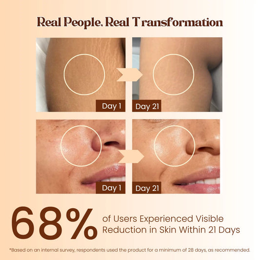 Pokonut Radiance Shield combo