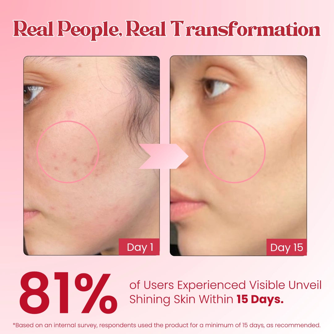 Skin shine Soap-100g