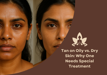 Tan on Oily vs. Dry Skin: Why One Needs Special Treatment