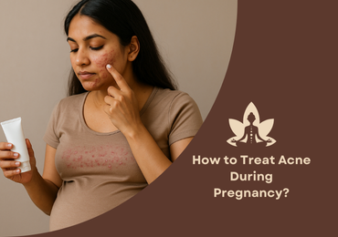 How to Treat Acne During Pregnancy?