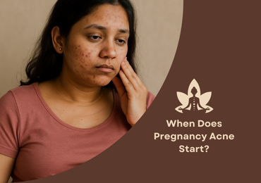 When Does Pregnancy Acne Start?