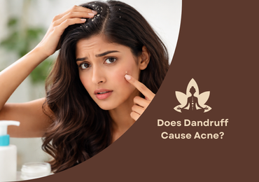 Does Dandruff Cause Acne?