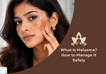 What Is Melasma? Causes, Symptoms, and How to Manage It Safely