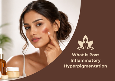 What Is Post Inflammatory Hyperpigmentation