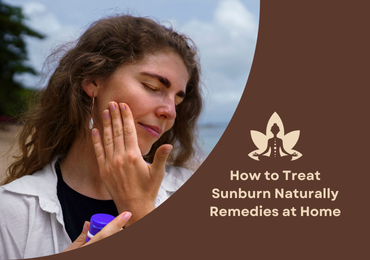 How to Treat Sunburn Naturally  Remedies at Home