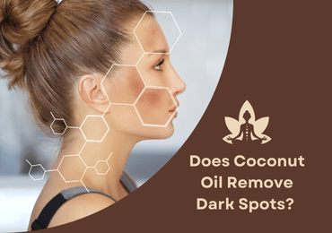 Does Coconut Oil Remove Dark Spots? Uncovering The Truth And Benefits