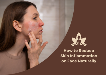 How to Reduce Skin Inflammation on Your Face Naturally