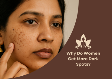 Why Do Women Get More Dark Spots