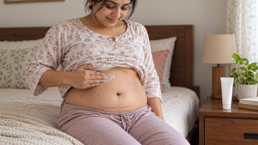 When Can I Apply Stretch Mark Cream After a C-Section