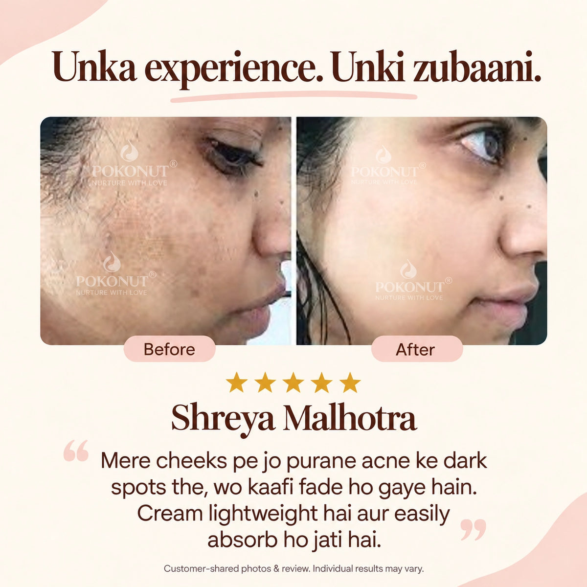Dark Spot Removal Cream