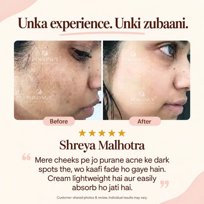 Dark Spot Removal Cream