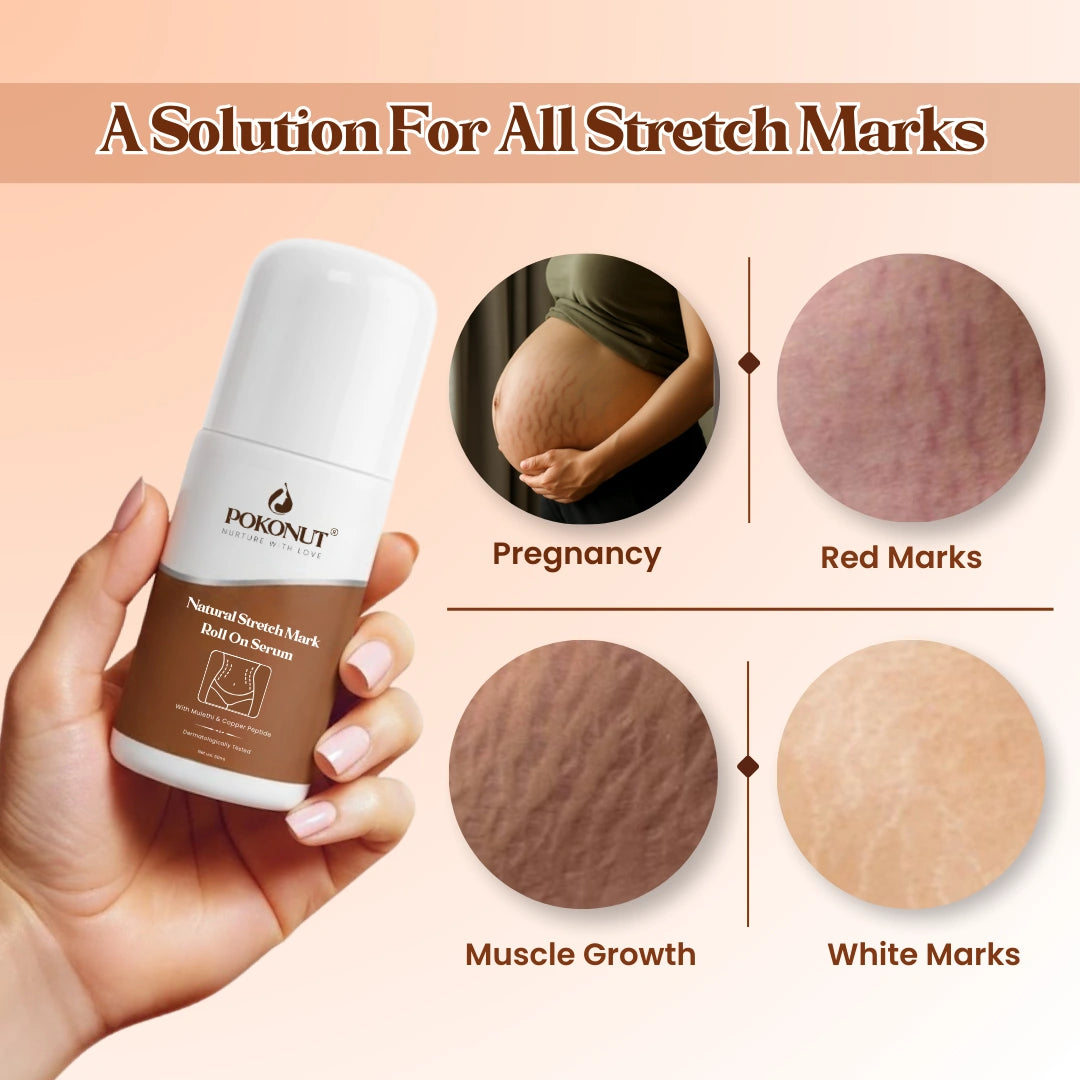 Stretch Mark Repair Combo – Day and Night Care for Visible Results