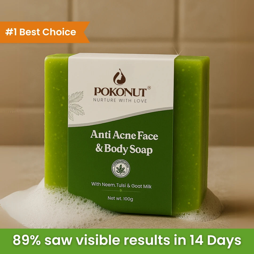 Anti acne soap -100g