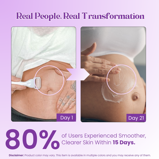 Derma Roller