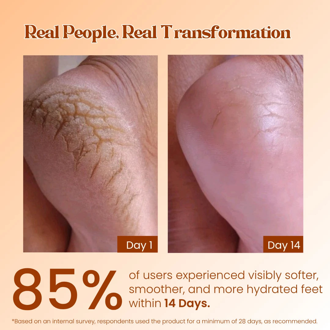 Foot Care Cream
