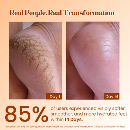 Foot Care Cream