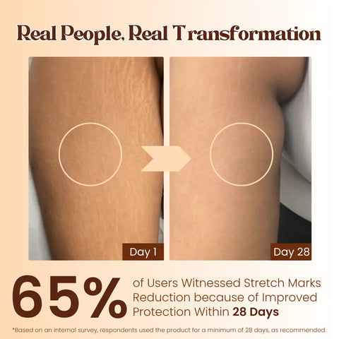 Pokonut Stretch Mark Cream