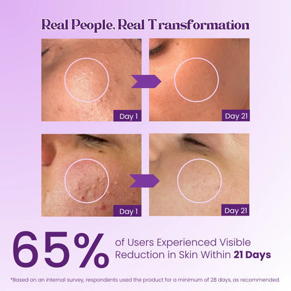 Pokonut Kumkumadi Radiance Kit