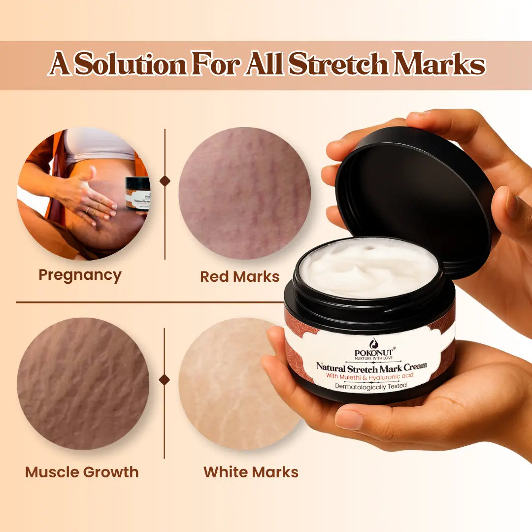 Pokonut Stretch Mark Cream