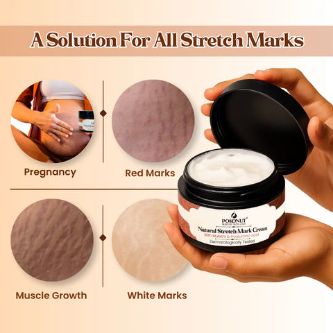 Pokonut Stretch Mark Cream