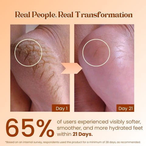 Foot Care Cream